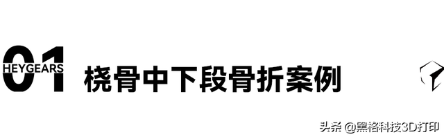 打了石膏痒怎么办