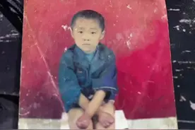 残疾小伙装假肢立志成为专业运动员图片