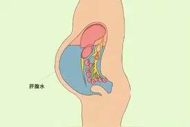 看不懂肝脏B超报告单怎么办？教你看懂报告上的暗语图片