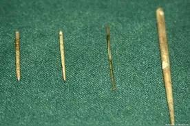 你知道中医眼科自古就有手术吗？图片