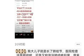 科兴：请直接面对图片