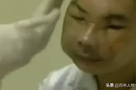 2004年，云南小伙放牛被狗熊抓成鬼脸，“换脸”半年后离奇死亡图片