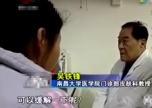 弥漫性表皮松懈角化症