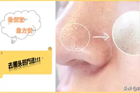 去黑头妙招全在这里！不要再用错误的方法去黑头了图片