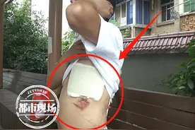 南昌一装修工人摔下脚手架，受伤入院！后续医药费，到底该谁出？图片