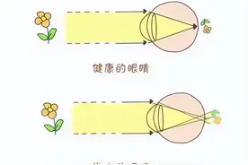 麦迪格眼科：孩子散光了怎么办？这里有你想知道的图片
