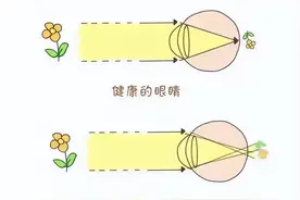 麦迪格眼科：孩子散光了怎么办？这里有你想知道的图片