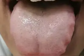 简单五味药 治疗脾肾阳虚，威力强大，名医都喜欢用它！图片