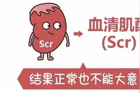 肌酐！肌酐！图片
