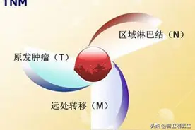 美国癌症联合会：乳腺癌的分型、分期及复发风险评估图片