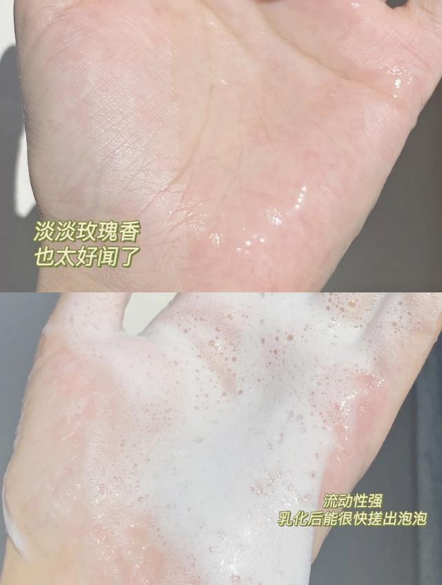 涂了身体乳还是有白屑