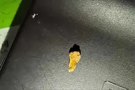 说说尿路结石的感受图片