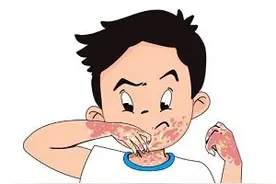 下巴红红的像癣怎么办图片