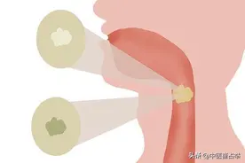 痰多脾湿大，痰少肝火旺，痰粘肺阴虚，健脾清肝滋肾，化一身之痰图片