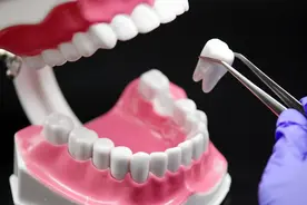 种植牙集采落地民营机构打起价格战，一颗种植牙到底便宜了多少？图片