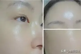 40岁后性价比高的医美抗衰清单（医生总结很实用）图片