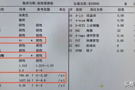 尿常规的小便该如何留才能获得正确结果？不要小看这些注意点图片