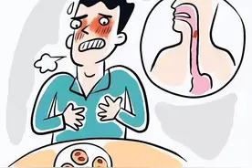 吞咽困难就一定是食管癌吗？图片