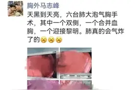 打个球肺竟炸了，这种病最近有点多，它尤爱“招惹”瘦高个男生图片