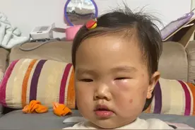 夏天防蚊请注意！这些止痒神器，比蚊子更伤娃图片
