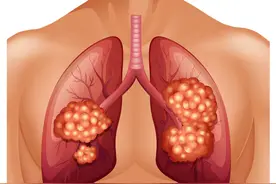 长期上夜班的人，最后都咋样了？可能要遭受5个后果，不止癌症图片
