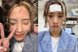 一时贪玩磕破额头、血流如注，身为肇事者的他幼稚未完图片