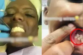 女子绑牙“绝食”49天，瘦身28斤走红网络：减肥的底层逻辑是什么图片