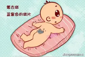 沸了！双胞胎在肚里打架出生后浑身淤青？！医生辟谣图片
