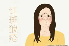 脸很红一直退不下去这是怎么了图片