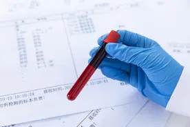 “血常规”真的能查出癌症吗？医生道出真相，越早知晓越好图片