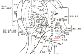 失眠治疗效果不佳时，试试地仓穴图片