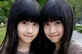 为什么人类双胞胎一模一样，而动物多胞胎为什么不一样图片