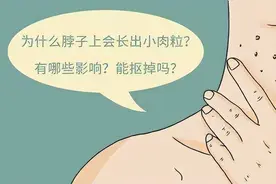 脖子和腋下的“小肉粒”是什么？能直接用手揪掉吗？看完要牢记图片