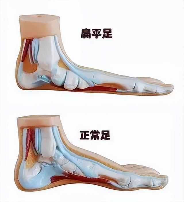 报名倒计时一个月！应征青年抓紧啦→体检标准