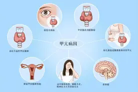 动不动就出汗，是身体太虚吗？提醒：身体5处多汗，不算好事图片