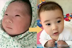 6个喂养细节和行为习惯，会“偷走”宝宝的颜值，及时纠正还不晚图片