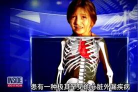 世界上最奇特的的十名小孩#奇特小孩图片