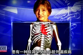 世界上最奇特的的十名小孩#奇特小孩图片