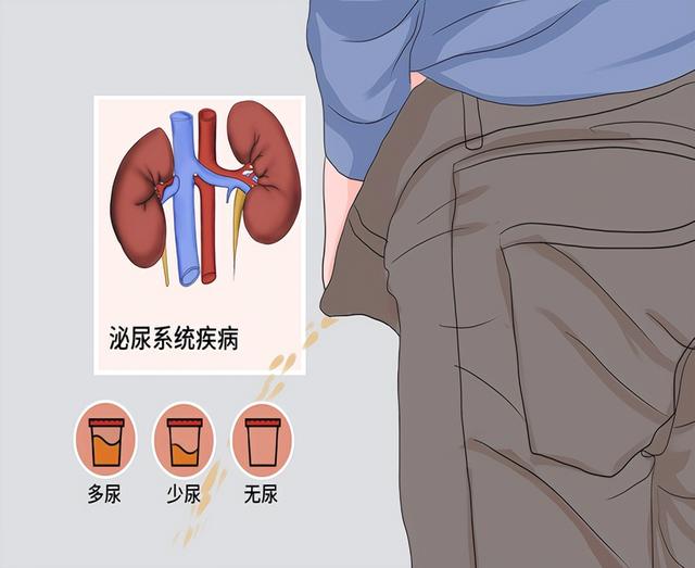 肾脏好不好，一泡尿就能知晓？尿量多少最健康？告诉你答案