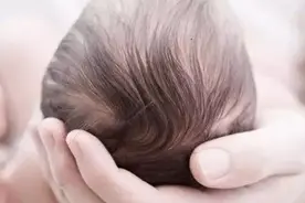 孩子头大还有些方，是不是喝的奶粉有问题？怎么判断是正常的？图片