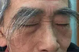 男人50岁后眉毛变长，意味着什么呢？医生给出解答，建议了解图片