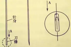 不是刀，但胜似刀，中西结合的小针刀治疗究竟是什么？图片