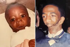 励志 美国男子天生没有下巴 吃饭呼吸都难 惨遭欺凌 如今却顺利逆袭图片