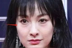 明星为美割眼袋：张蔷手术失败骂医生，郭京飞立马年轻20岁图片