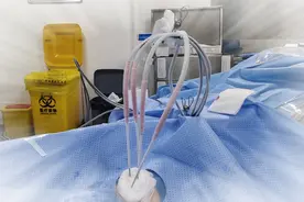 专家提醒：警惕一种“肉瘤”，或比癌症还可怕，患者存活率低图片