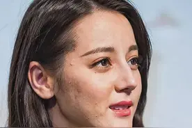 精修的是神颜，生图满脸痘，痘坑、黑眼圈、长斑，明星没那么美图片