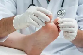 得了脚气用什么药呢？又臭又湿，3个步骤用药，让脚干净舒爽图片