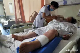 盛夏，当心蛇出没！陕西一医院急诊外科每天都要接诊三五例蛇咬伤患者图片