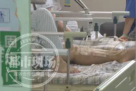 男子喝完酒倒头就睡！一觉醒来，小腿差点就没了图片