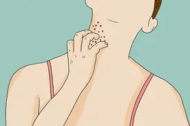 脖子和腋下的“小肉球”，到底是皮肤病，还是HPV感染？怎么治？图片